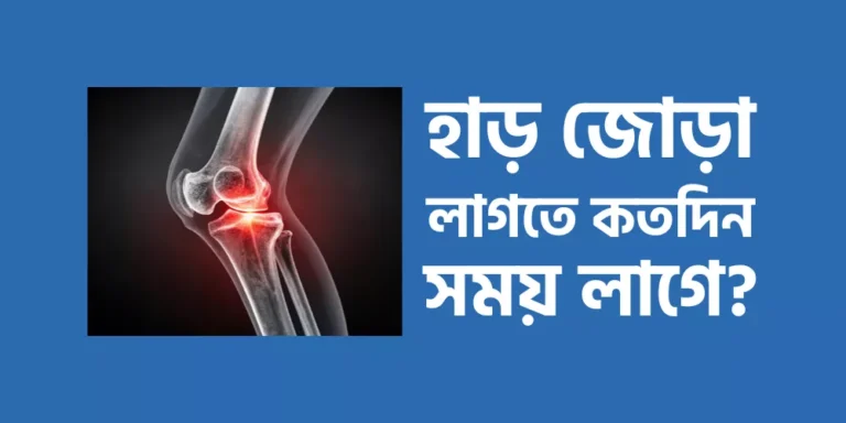 হাড় জোড়া লাগতে কতদিন সময় লাগে?