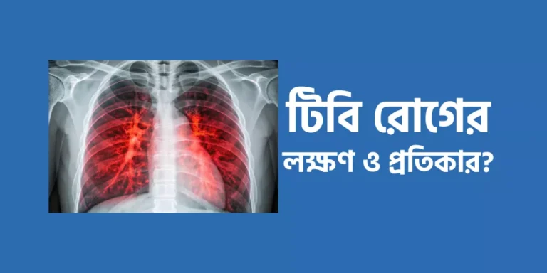 টিবি রোগের লক্ষণ ও প্রতিকার?