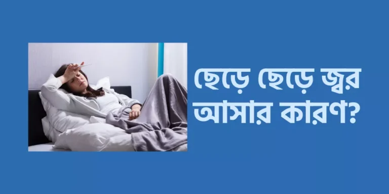 ছেড়ে ছেড়ে জ্বর আসার কারণ?