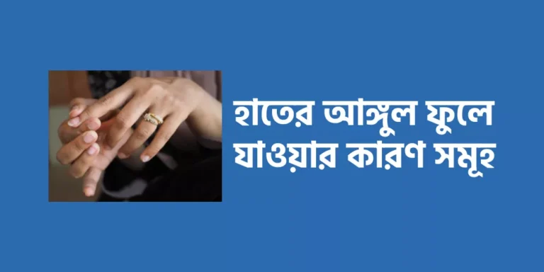 হাতের আঙ্গুল ফুলে যাওয়ার কারণ সমূহ